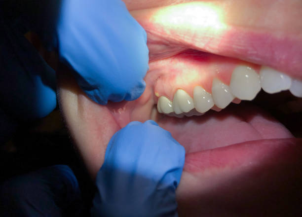 Best Broken or Cracked Tooth Emergency Dentist in West Newton, PA